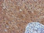 FBXO21 Antibody in Immunohistochemistry (Paraffin) (IHC (P))