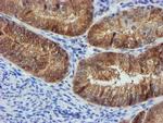 FBXO21 Antibody in Immunohistochemistry (Paraffin) (IHC (P))