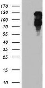 FBXO21 Antibody in Western Blot (WB)