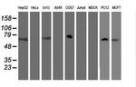 FBXO21 Antibody in Western Blot (WB)