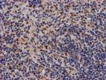 MKRN1 Antibody in Immunohistochemistry (Paraffin) (IHC (P))