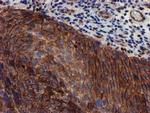 MKRN1 Antibody in Immunohistochemistry (Paraffin) (IHC (P))