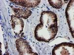 MKRN1 Antibody in Immunohistochemistry (Paraffin) (IHC (P))