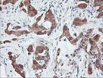 PFDN6 Antibody in Immunohistochemistry (Paraffin) (IHC (P))