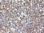 PFDN6 Antibody in Immunohistochemistry (Paraffin) (IHC (P))