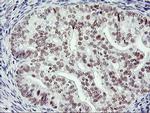 RNF113B Antibody in Immunohistochemistry (Paraffin) (IHC (P))