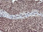 TPSG1 Antibody in Immunohistochemistry (Paraffin) (IHC (P))