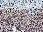 TPSG1 Antibody in Immunohistochemistry (Paraffin) (IHC (P))