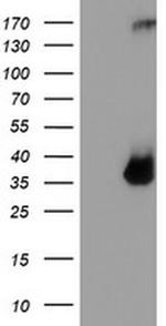 TPSG1 Antibody in Western Blot (WB)