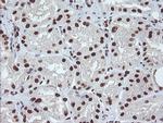 EXOSC7 Antibody in Immunohistochemistry (Paraffin) (IHC (P))