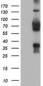 TLE2 Antibody in Western Blot (WB)