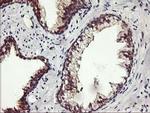 ALG2 Antibody in Immunohistochemistry (Paraffin) (IHC (P))