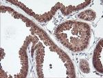 MAOA Antibody in Immunohistochemistry (Paraffin) (IHC (P))