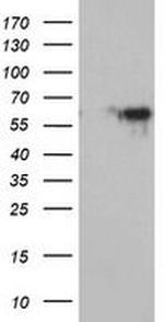 MAOA Antibody in Western Blot (WB)