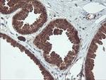 MAOA Antibody in Immunohistochemistry (Paraffin) (IHC (P))