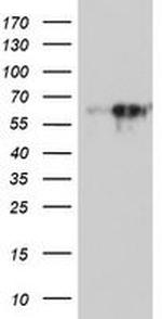 MAOA Antibody in Western Blot (WB)