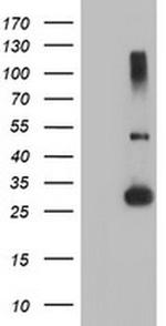 RFXANK Antibody in Western Blot (WB)