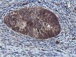 Epsin 2 Antibody in Immunohistochemistry (Paraffin) (IHC (P))