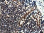 Epsin 2 Antibody in Immunohistochemistry (Paraffin) (IHC (P))