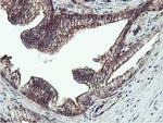 Epsin 2 Antibody in Immunohistochemistry (Paraffin) (IHC (P))