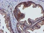 Epsin 2 Antibody in Immunohistochemistry (Paraffin) (IHC (P))