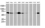 Epsin 2 Antibody in Western Blot (WB)