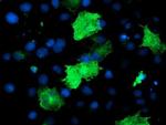 Epsin 2 Antibody in Immunocytochemistry (ICC/IF)