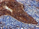 Epsin 2 Antibody in Immunohistochemistry (Paraffin) (IHC (P))