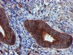 Epsin 2 Antibody in Immunohistochemistry (Paraffin) (IHC (P))