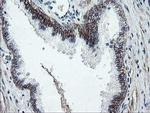 DTNB Antibody in Immunohistochemistry (Paraffin) (IHC (P))