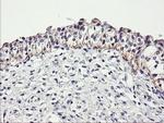 DTNB Antibody in Immunohistochemistry (Paraffin) (IHC (P))