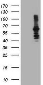 DTNB Antibody in Western Blot (WB)