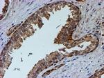 PSMB9 Antibody in Immunohistochemistry (Paraffin) (IHC (P))