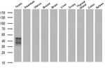 SH2D2A Antibody in Western Blot (WB)