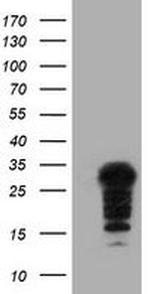 SSX5 Antibody in Western Blot (WB)
