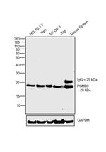 PSMB9 Antibody in Western Blot (WB)