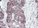 PDRG1 Antibody in Immunohistochemistry (Paraffin) (IHC (P))