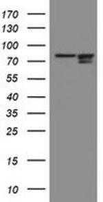 SPG7 Antibody in Western Blot (WB)