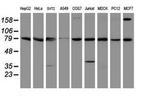 SPG7 Antibody in Western Blot (WB)