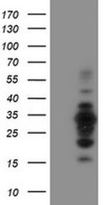 MIF4GD Antibody in Western Blot (WB)