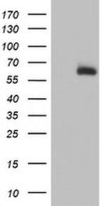 ACSM5 Monoclonal Antibody (OTI4B11)