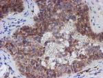 SPATC1L Antibody in Immunohistochemistry (Paraffin) (IHC (P))
