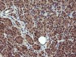 PPAT Antibody in Immunohistochemistry (Paraffin) (IHC (P))