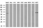 ACSF2 Antibody in Western Blot (WB)
