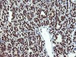 MPI Antibody in Immunohistochemistry (Paraffin) (IHC (P))