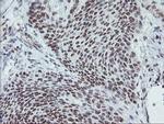 MLF1 Antibody in Immunohistochemistry (Paraffin) (IHC (P))