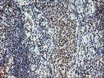 MLF1 Antibody in Immunohistochemistry (Paraffin) (IHC (P))