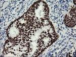 MLF1 Antibody in Immunohistochemistry (Paraffin) (IHC (P))