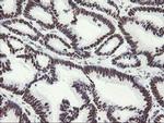MLF1 Antibody in Immunohistochemistry (Paraffin) (IHC (P))