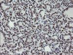 MLF1 Antibody in Immunohistochemistry (Paraffin) (IHC (P))